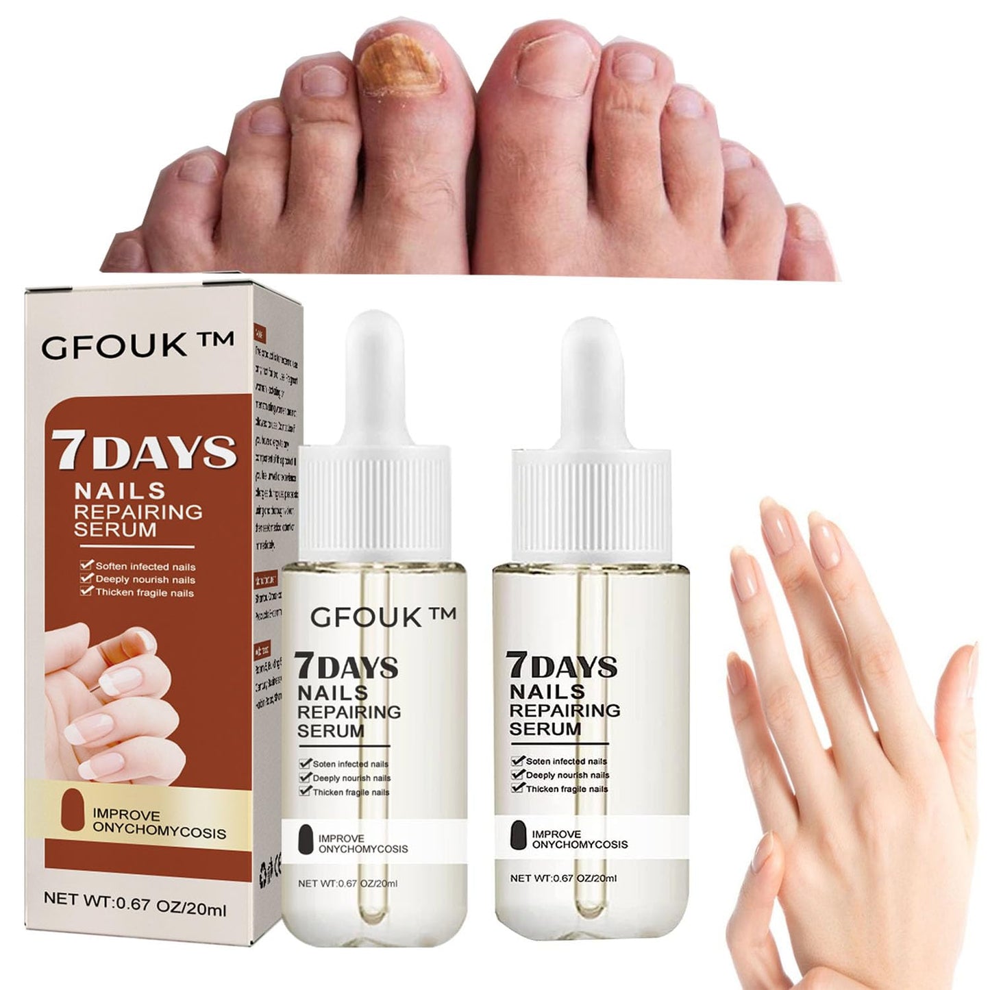 7 - Day Nail Repair Serum: Inhibits Fungal Growth and Restores Healthy Nails - sklepe.com - 