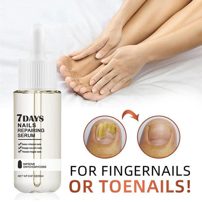 7 - Day Nail Repair Serum: Inhibits Fungal Growth and Restores Healthy Nails - sklepe.com - 