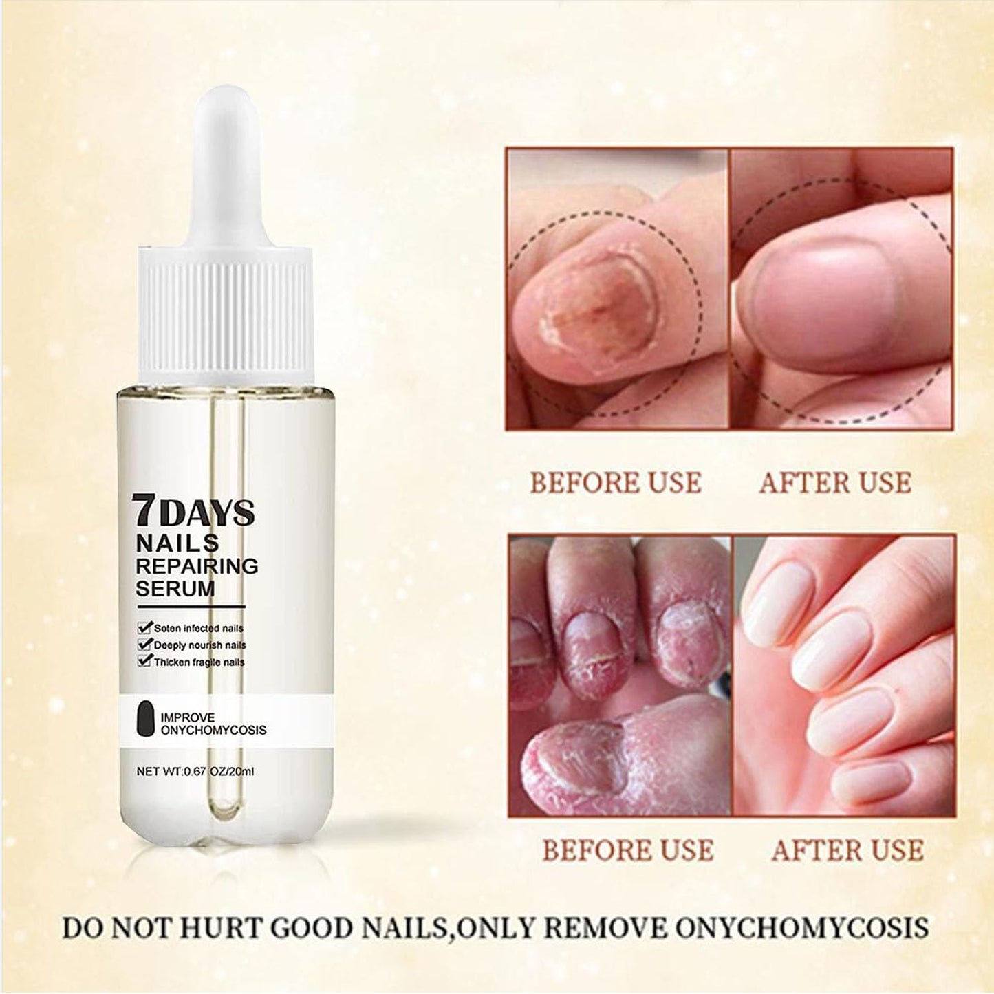 7 - Day Nail Repair Serum: Inhibits Fungal Growth and Restores Healthy Nails - sklepe.com - 